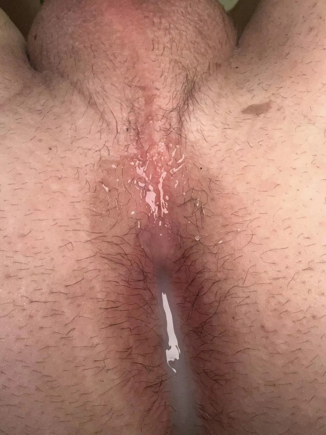 Would you add more m19 posted by Sensitive-Reaction13