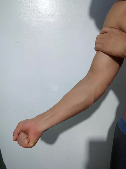 He squeezed my forearms!! by gonzalo_hillary