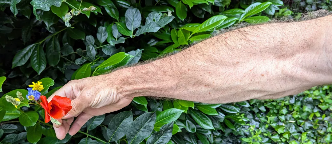 Veins, freckles, hair, what else? posted by Neighbor_72
