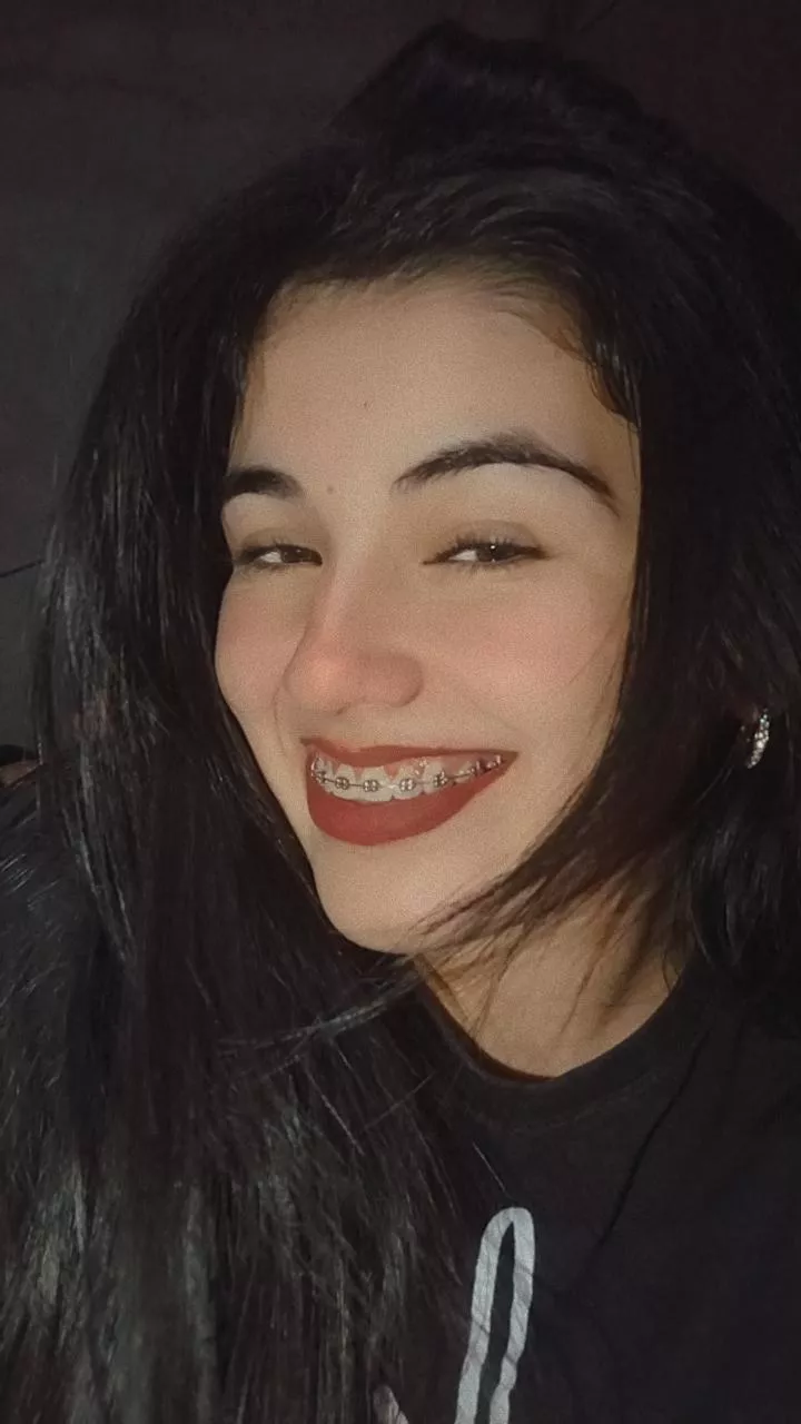 Braces smile posted by barbyantonela