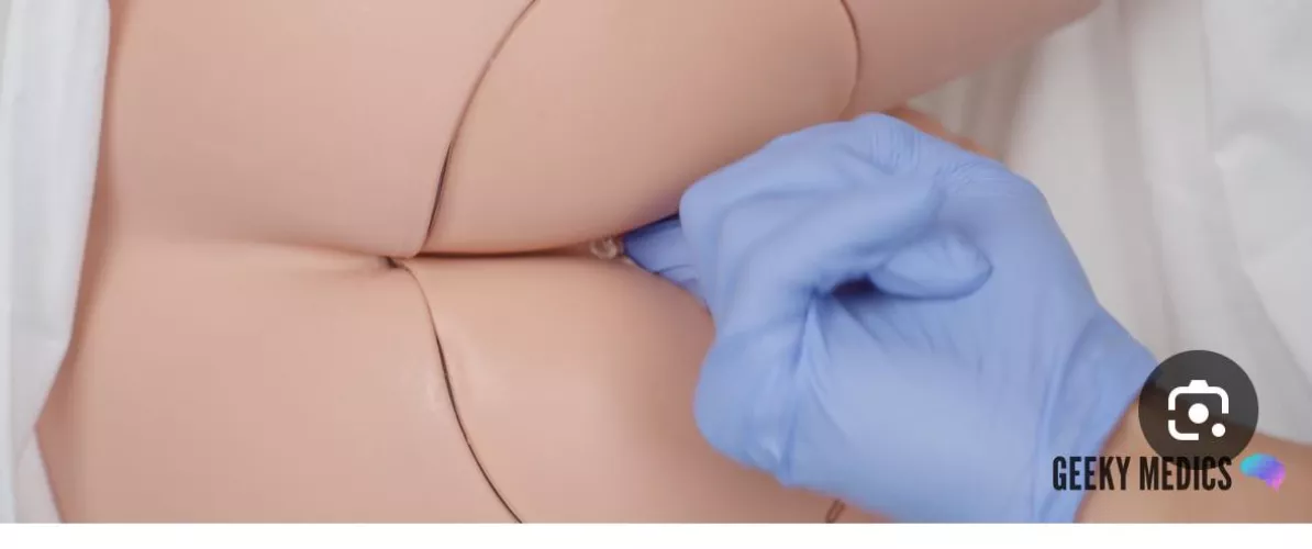 Rectal exam by Middle_Teacher3596