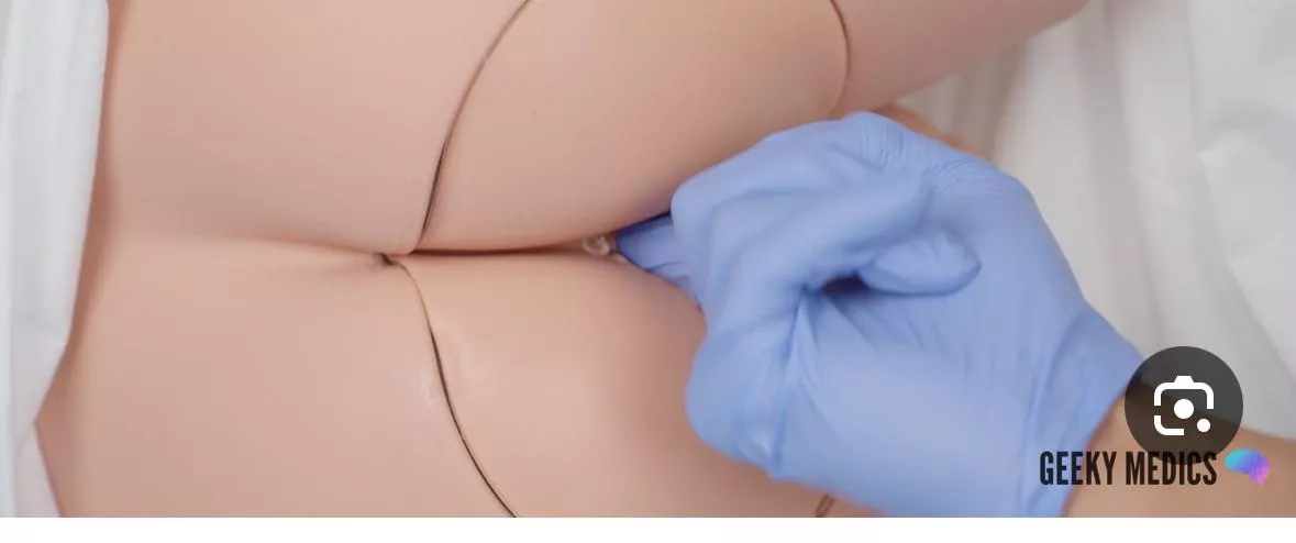 Rectal exam posted by Middle_Teacher3596