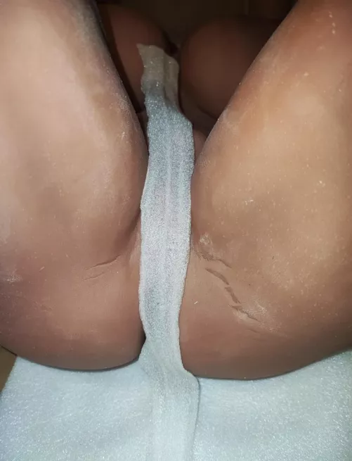 Need help… my doll came damaged by tmxwhite