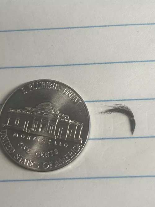 My belly button hair clump by BHO-IsBack