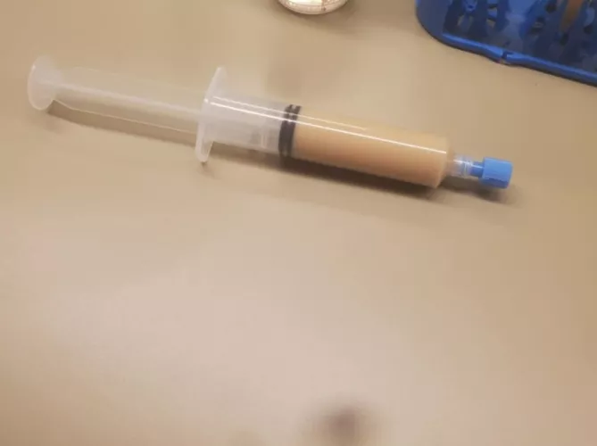 Went to get lymph node biopsy and there was a cyst there aswell this is what was drained  by SheepDick69