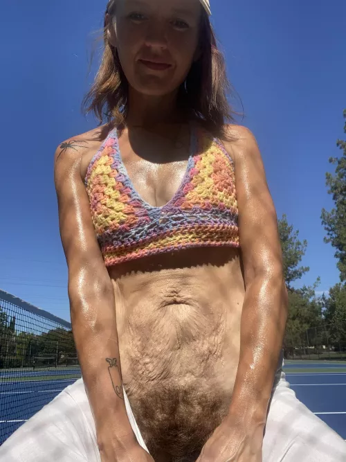 Hairy with a side of stretch marks  by Critical-Storm1675