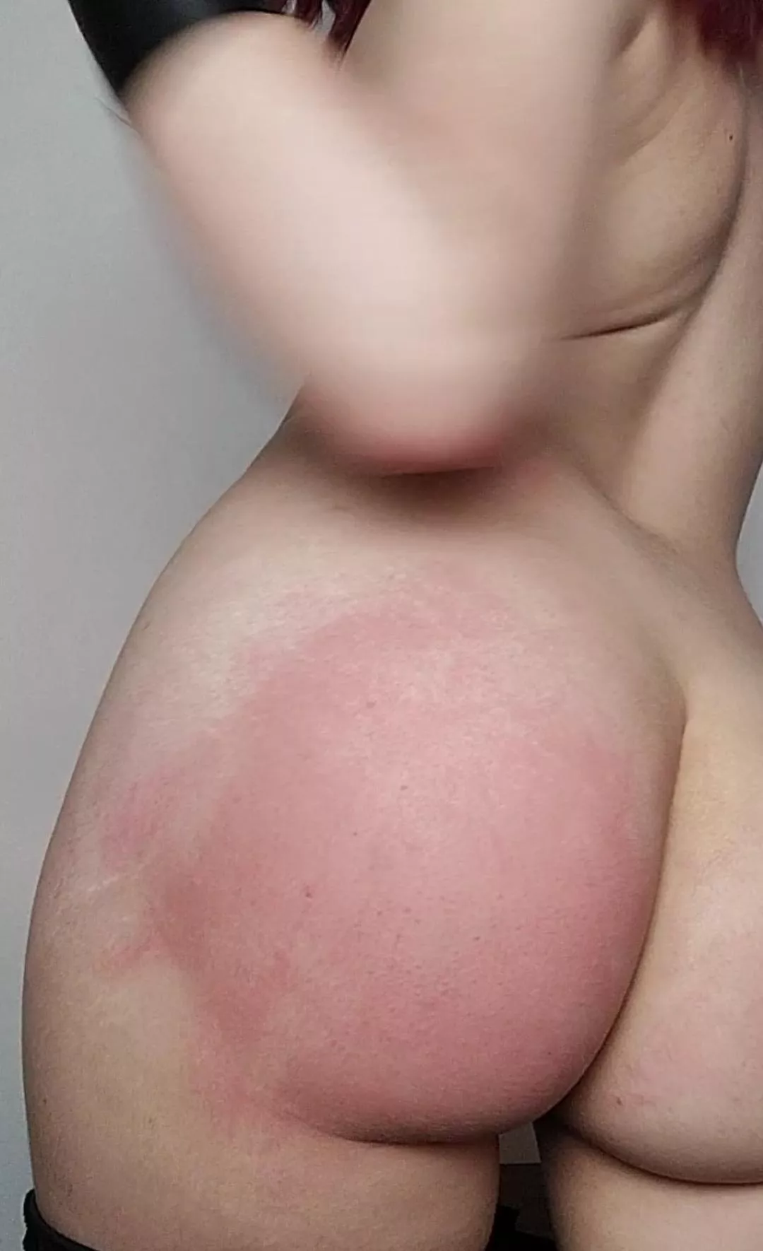 I hope it doesn't bruise... posted by panderdab