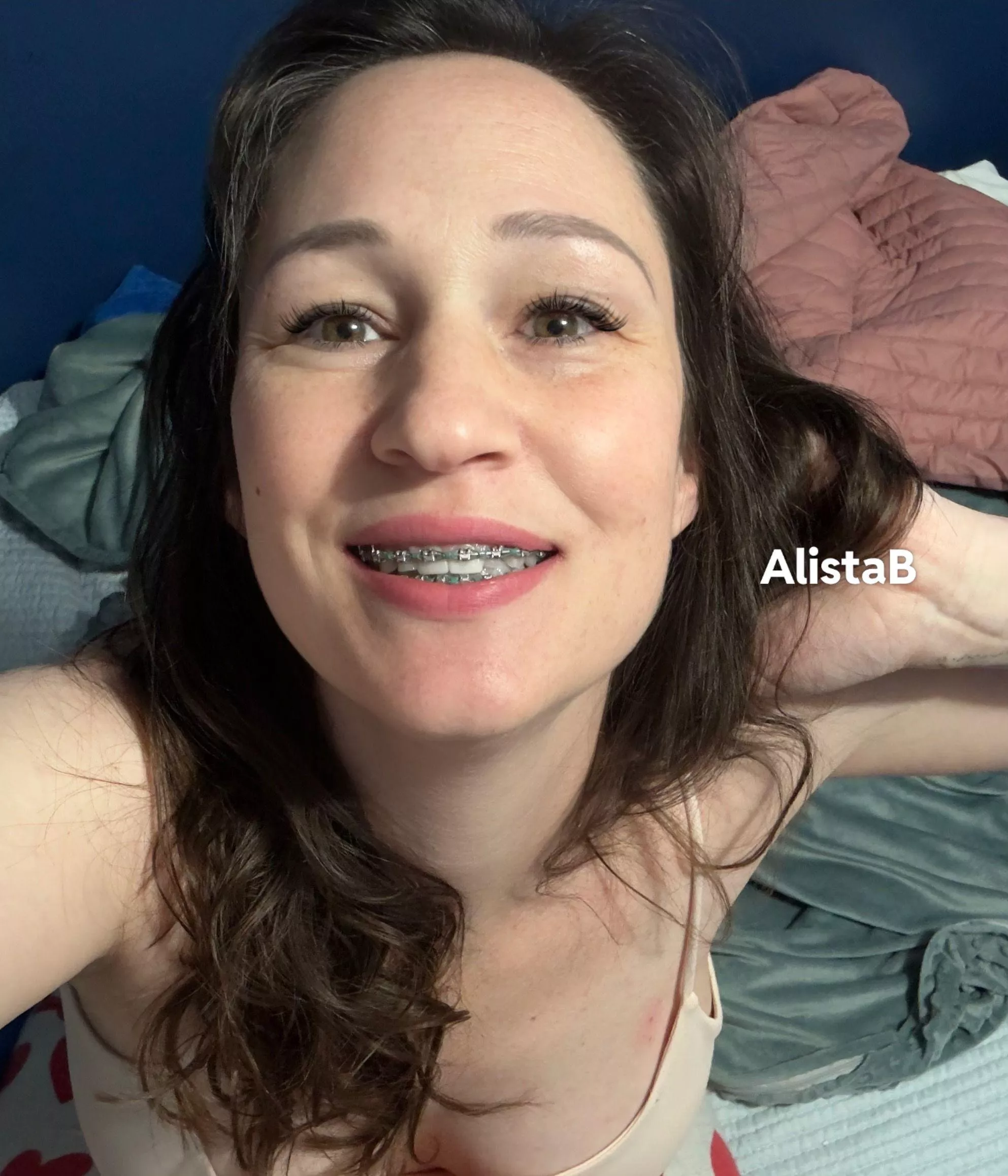 Like braces and big personalities... @alistabug posted by AlistaB