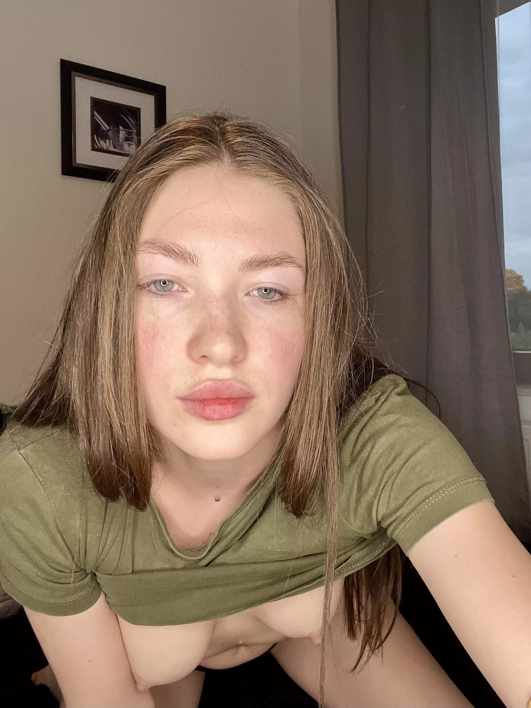 My freckles are up here [IRTR] posted by ThickInitiative7733