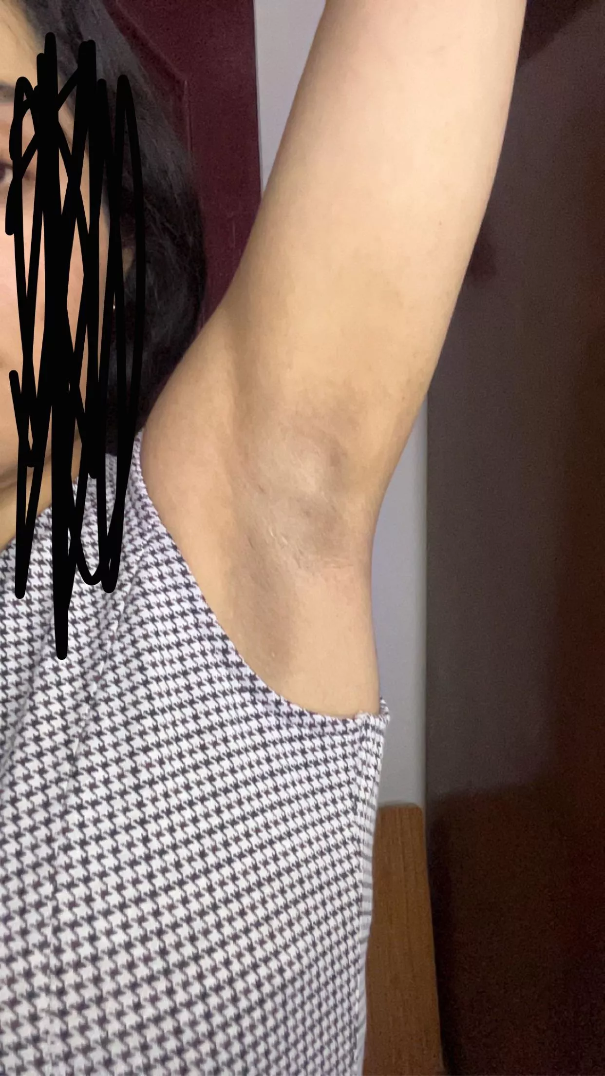 Any recommendations to lighten these underarms. posted by PerspectiveSilver19