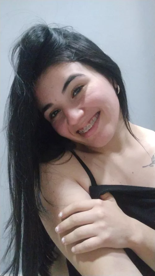 I have 29 days left with my braces🥺 by barbyantonela