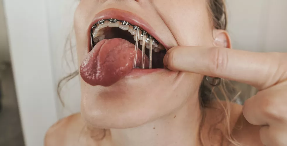 I think this is my favorite elastics configuration yet by andie_x