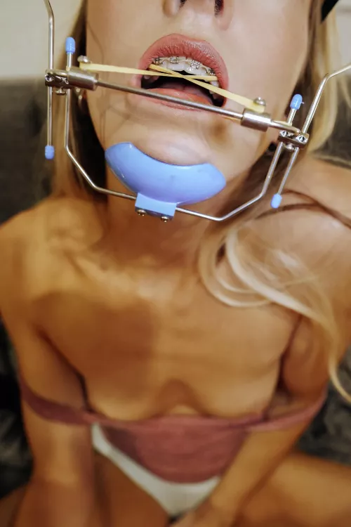 Naughty little braces freak 🙋🏼‍♀️ by andie_x