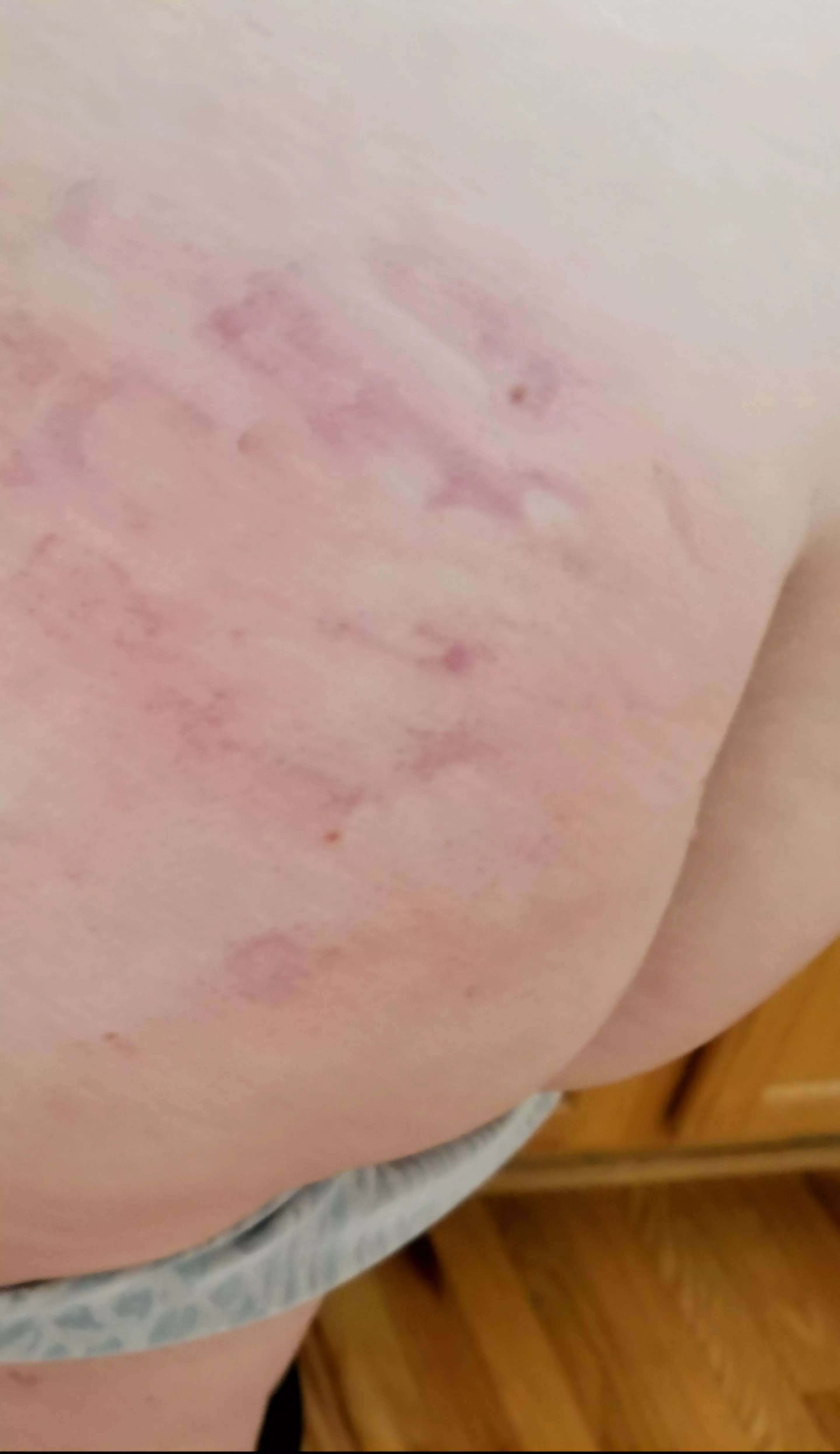 Pimp hand posted by Agreeable-Spread397