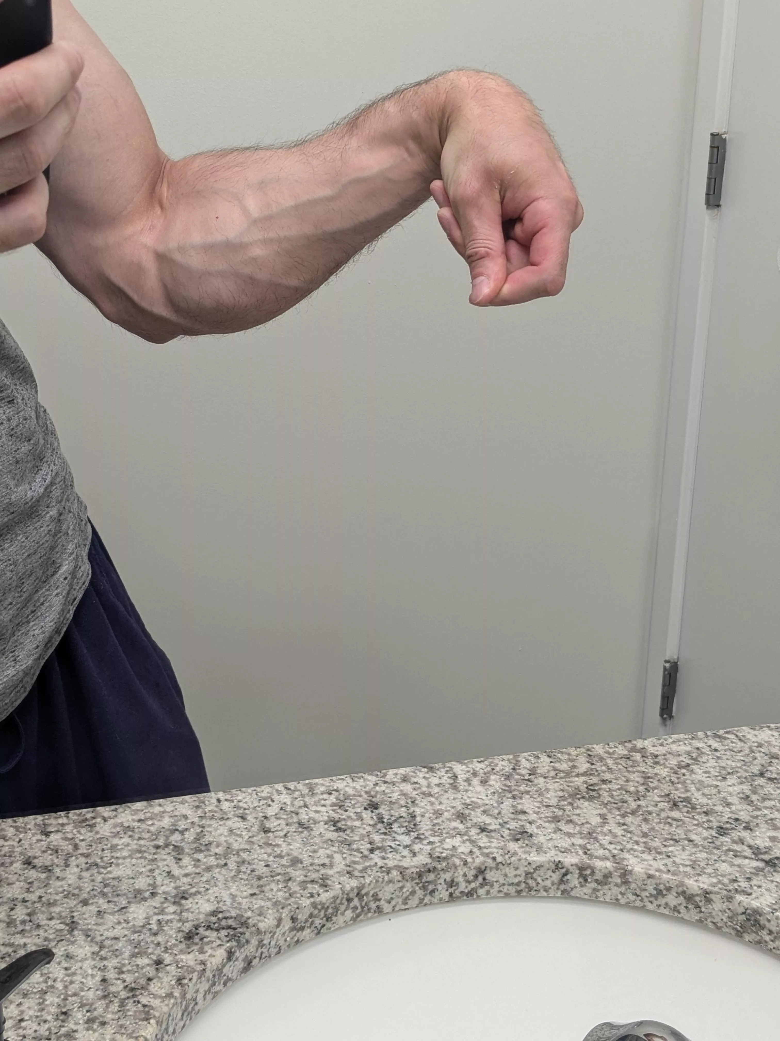 Wrist flexors posted by No_Change8232