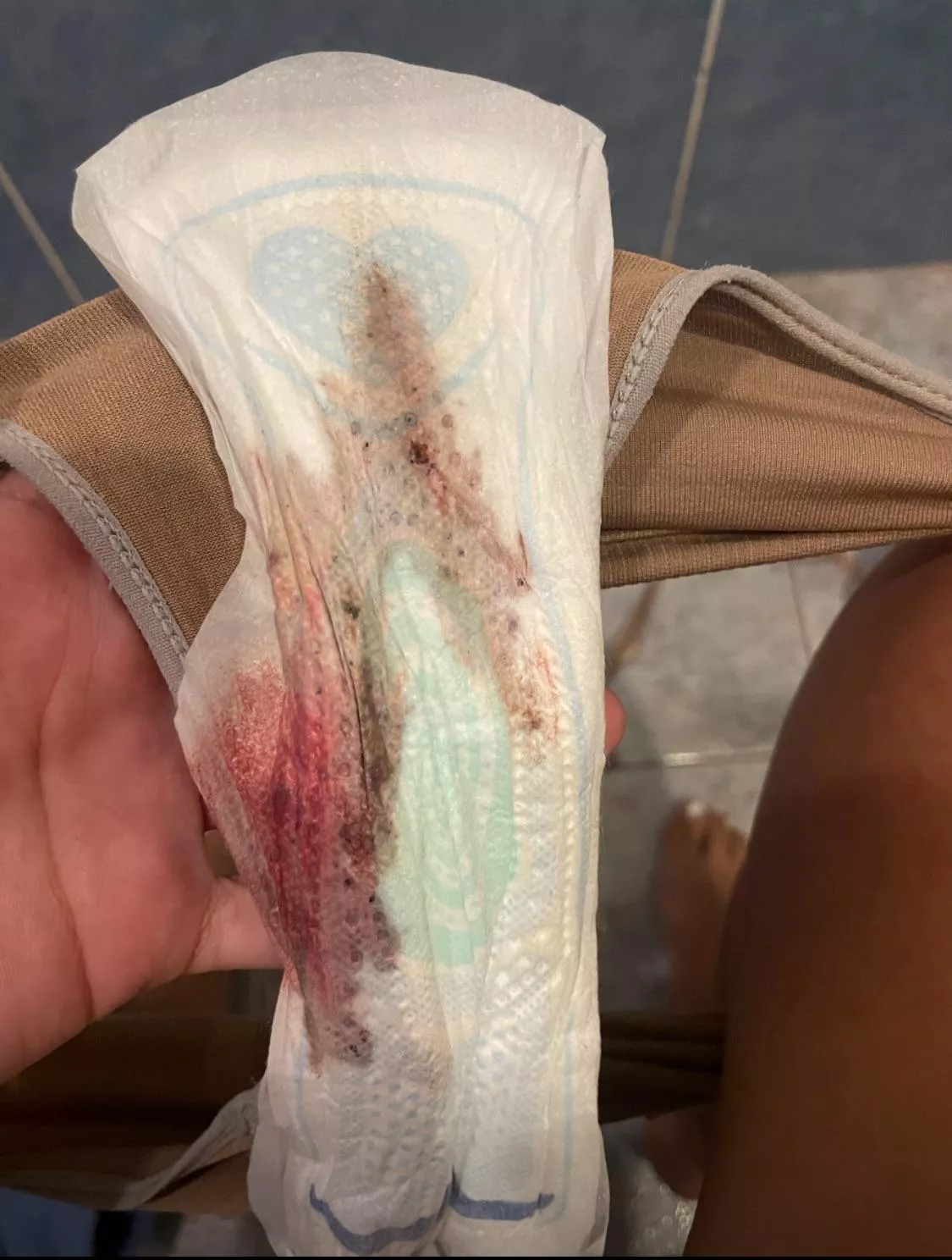 Mestruation content here  posted by KatyAurora