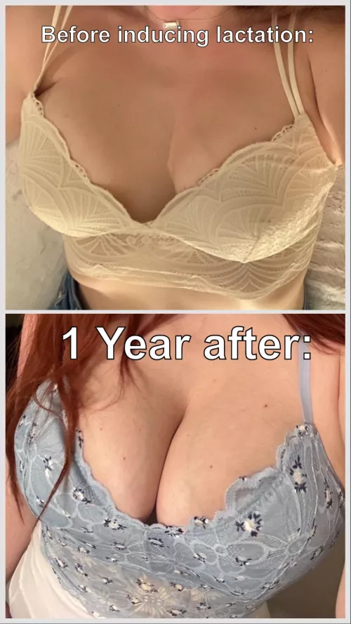 1 year of making milk, never pregnant (before & 1 yr after inducing lactation) by MilkyWaye3023