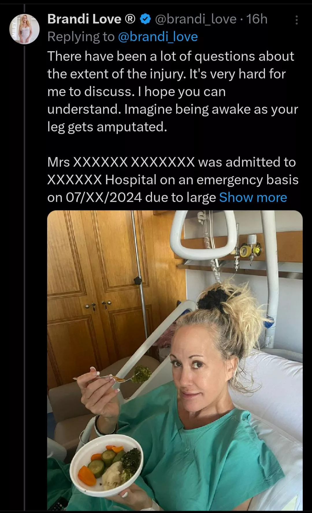Brandi Love severely injured in boating accident during Greece trip. Leg is mangled and amputation was considered.  posted by Throwawaydecent1