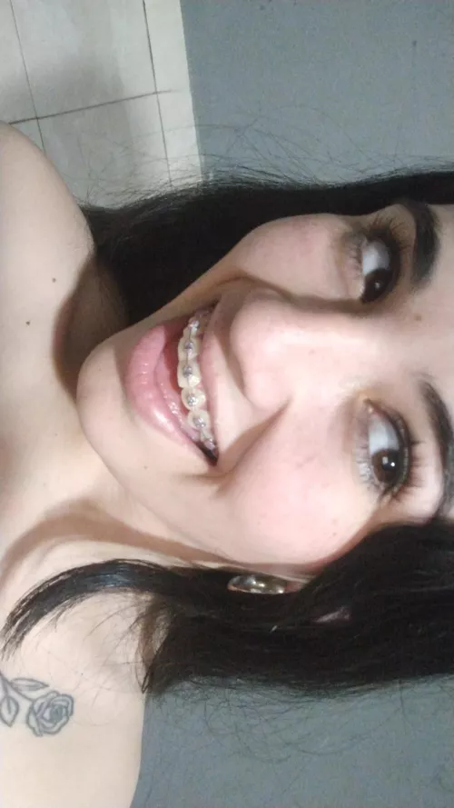 What do you think this little face with braces can do to you? by barbyantonela