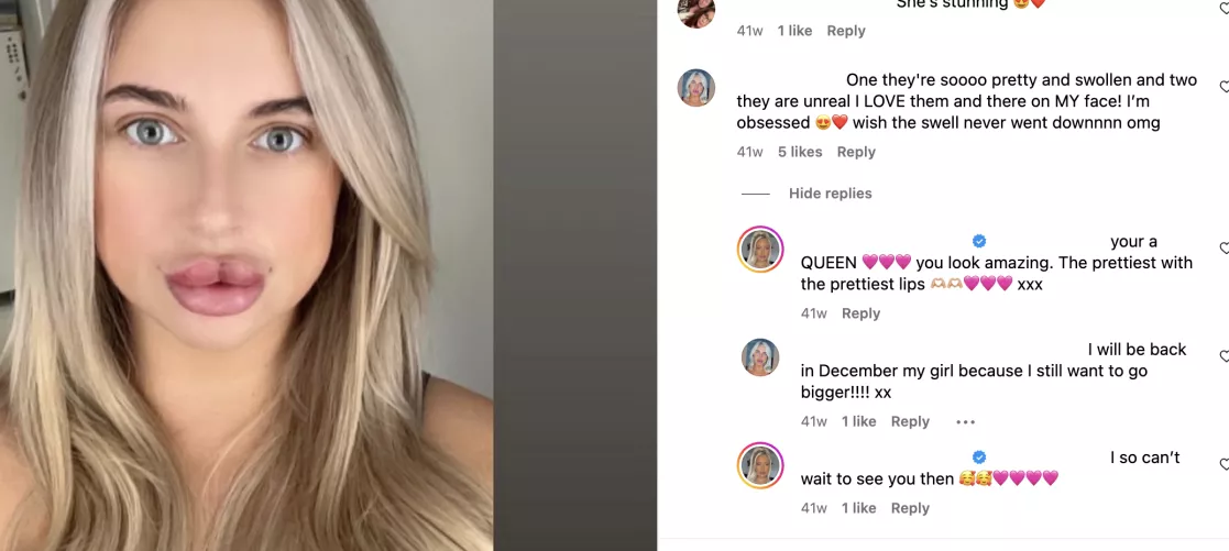 1.5ml in JUST the top lip by anonyyyymuser