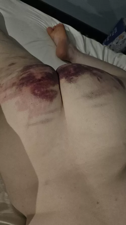 Someone couldn't sit comfortably  by Traditional-Key5784