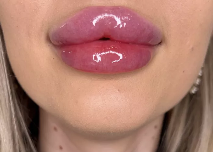 Straight off the needle by anonyyyymuser