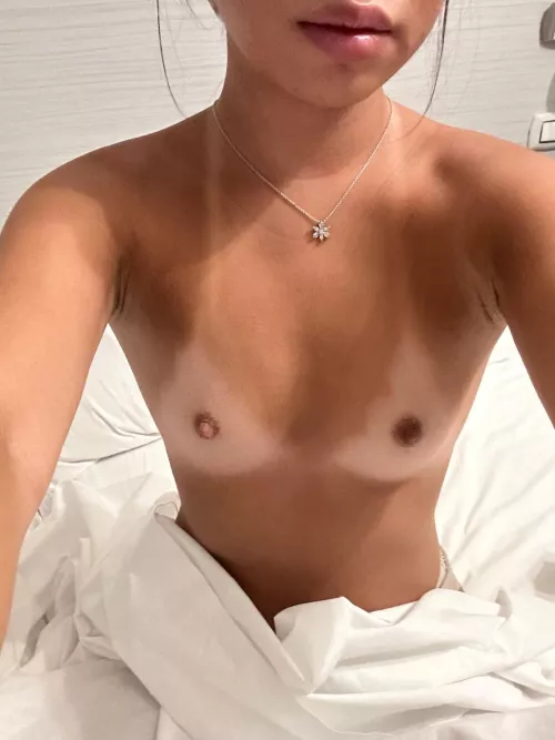 What would you call them, mosquito bites? by InellGore