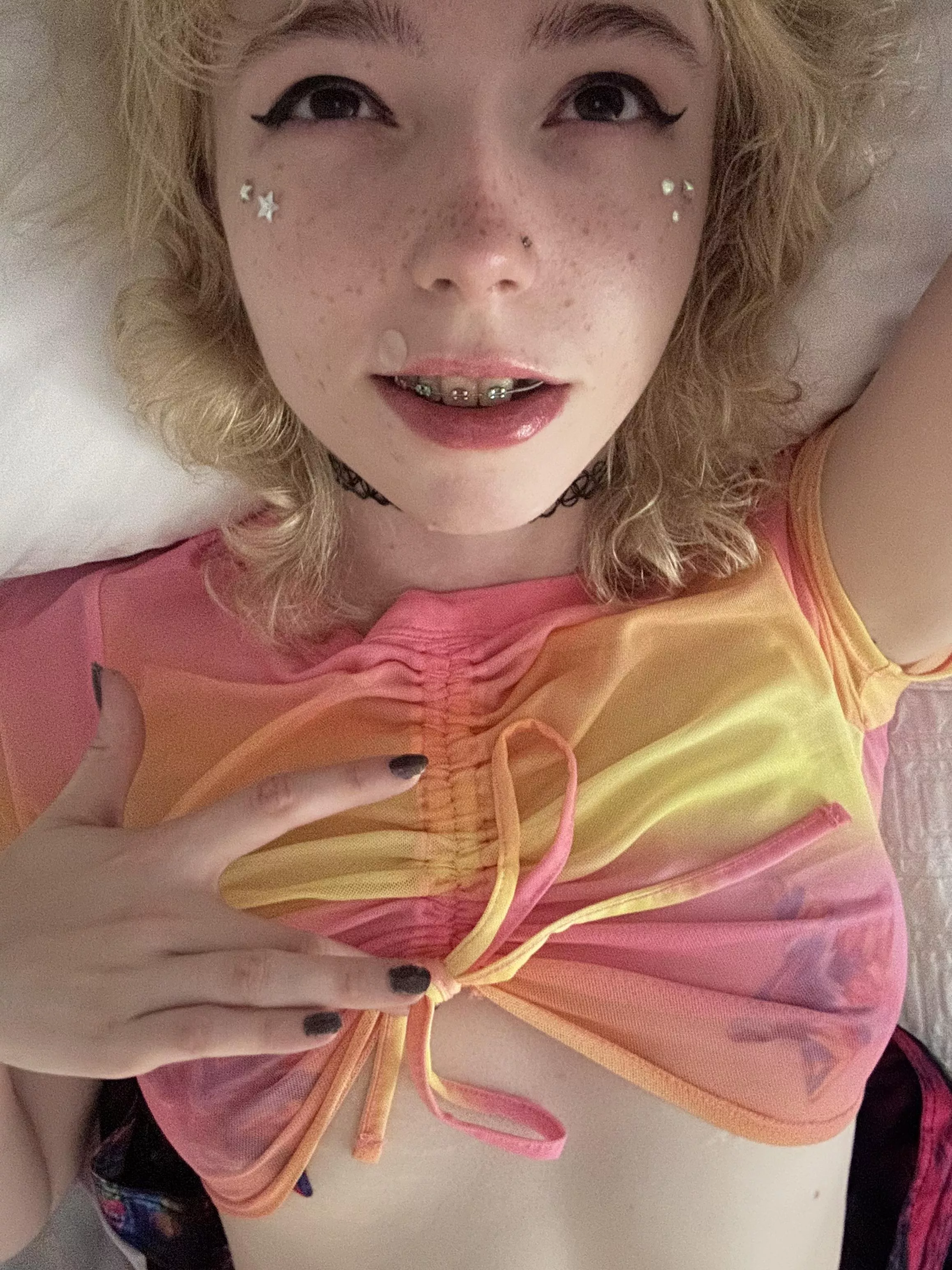 my colorful braces complete my colorful outfit :3 posted by brainlssbarbi