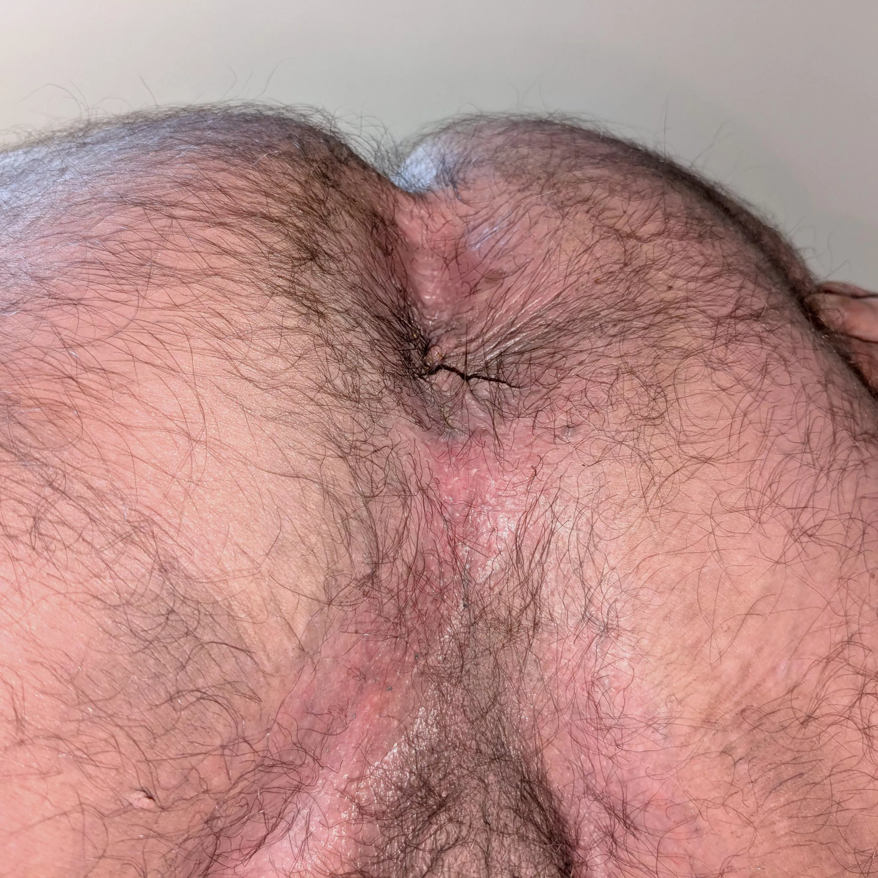 Wanna lick the sweat of my hairy hole? posted by justfappingagain