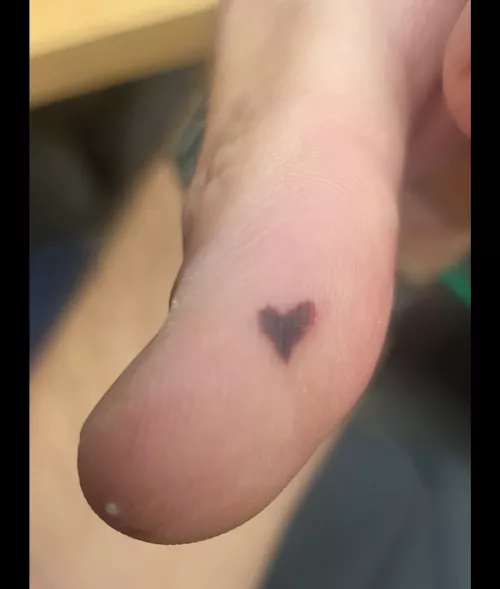Heart shaped blood blister by Caddacus
