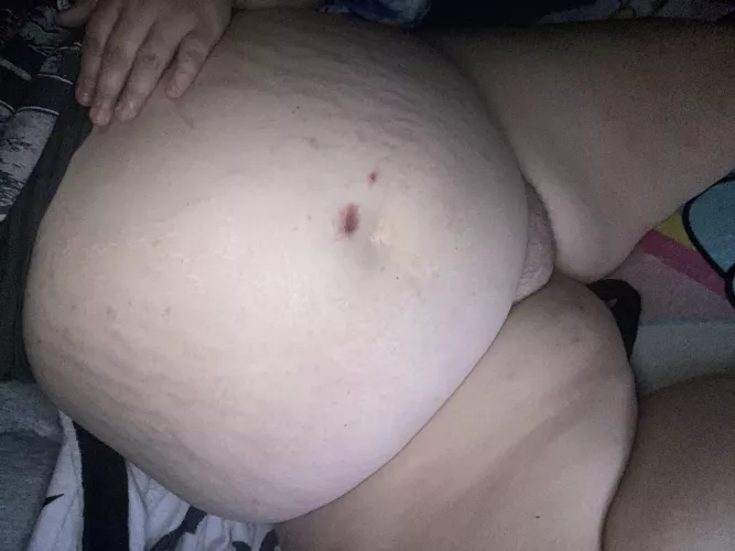 I’m so swollen  by xnikkixhorrorx