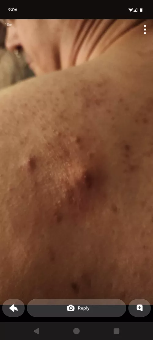 This guy and friends are brutalizing my back. by ImSmilingSimon