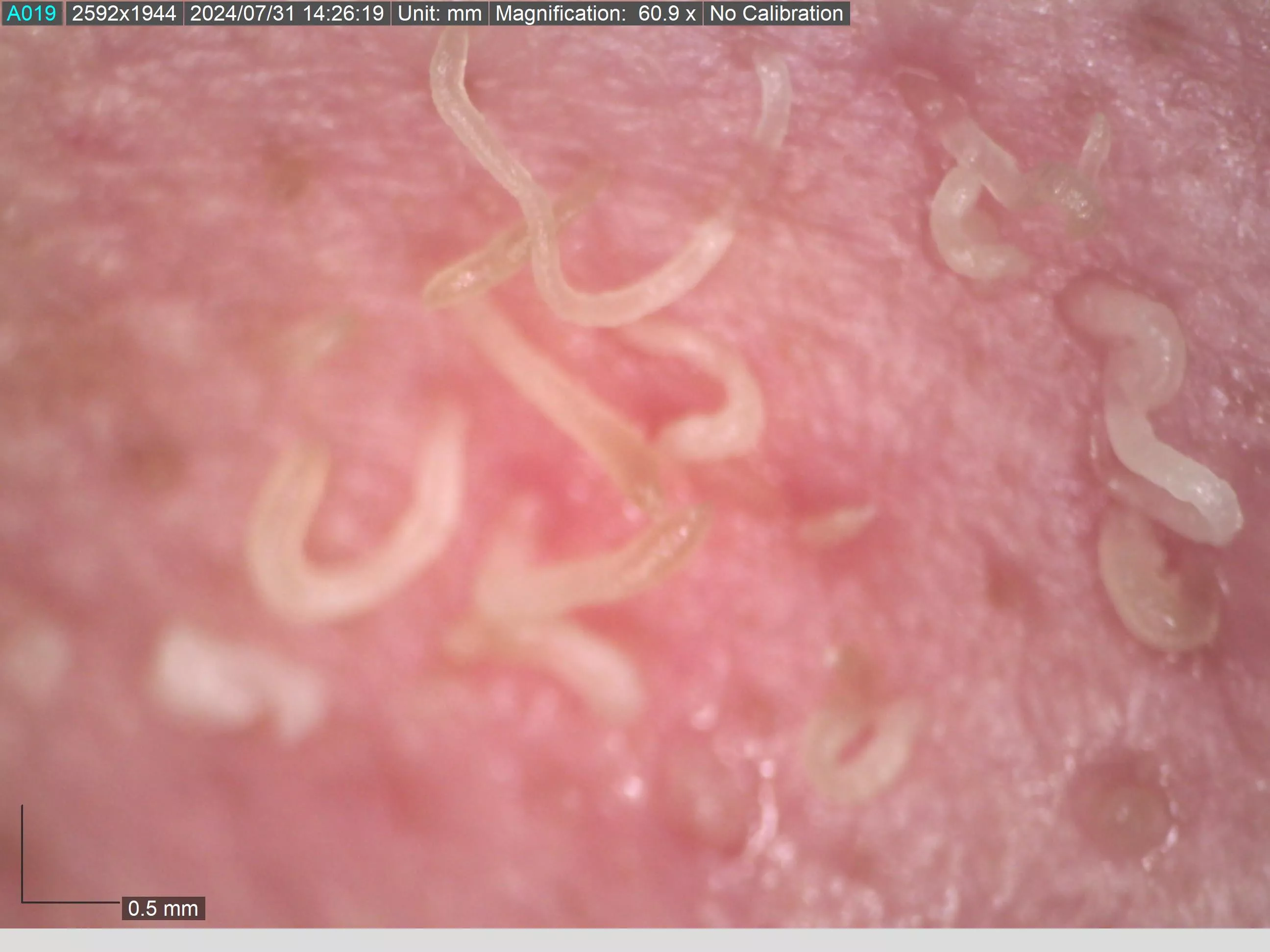 Post nose squeeze 60x magnification  posted by TheShitley