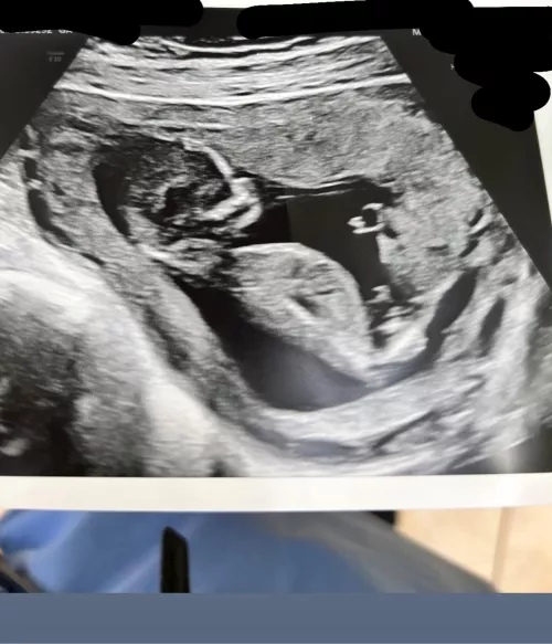 Gender predictions? by Individual-person691