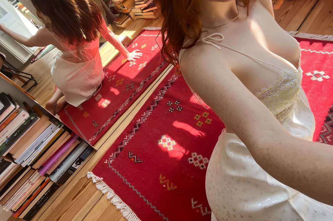 [IRTR] freckles evvverywhere :) posted by helloitsdaisy_