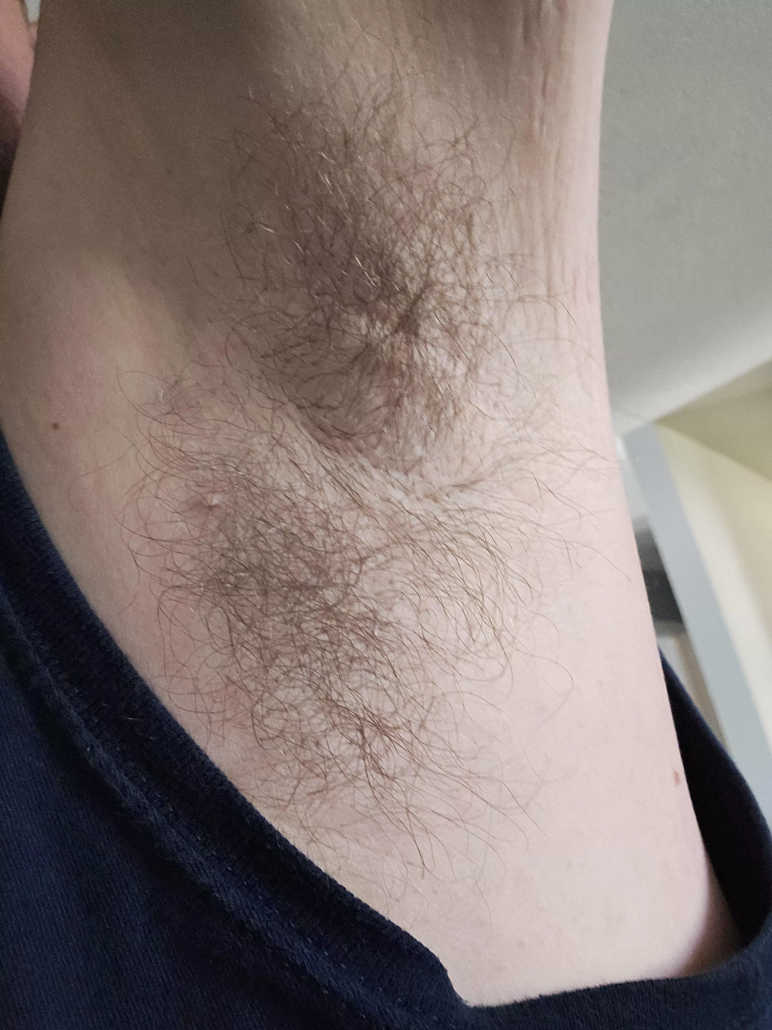 Over 3 years no deodorant. posted by Significant-Novel709