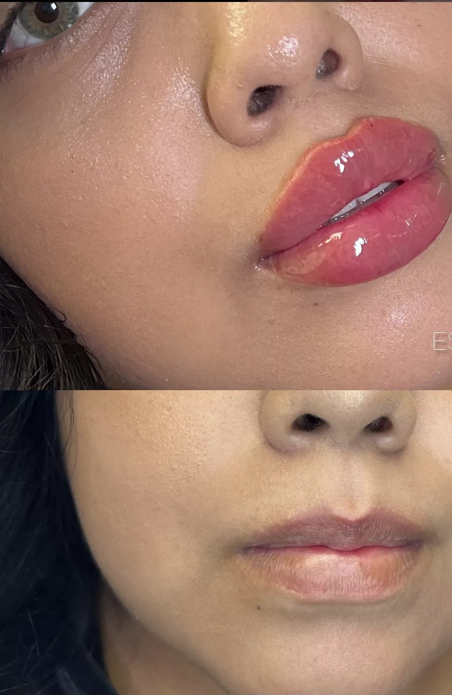 After vs natural posted by anonyyyymuser