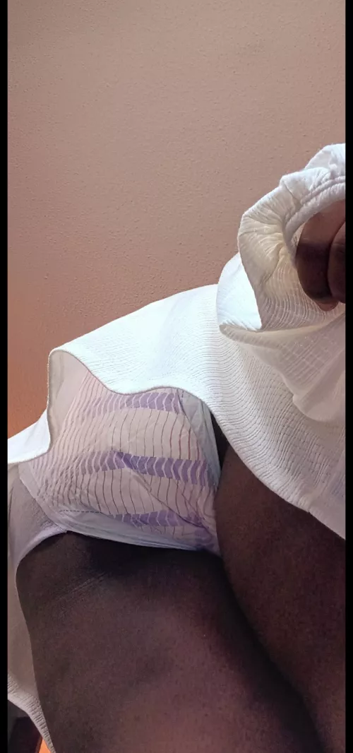 You reach to pick up something you dropped and catch a glimpse of what's under my skirt. What would you do next? (,,> . <,,) by Fantastic_Point5211