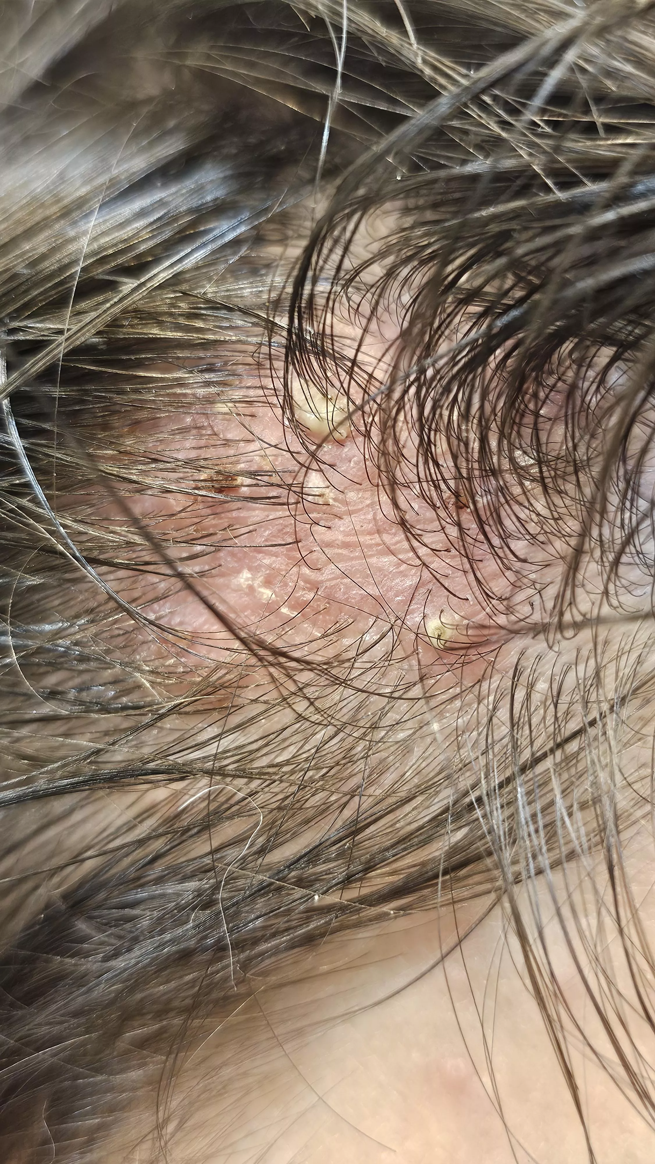 Doc says I can't pop sorry guys trust me I want to... posted by fiesel21