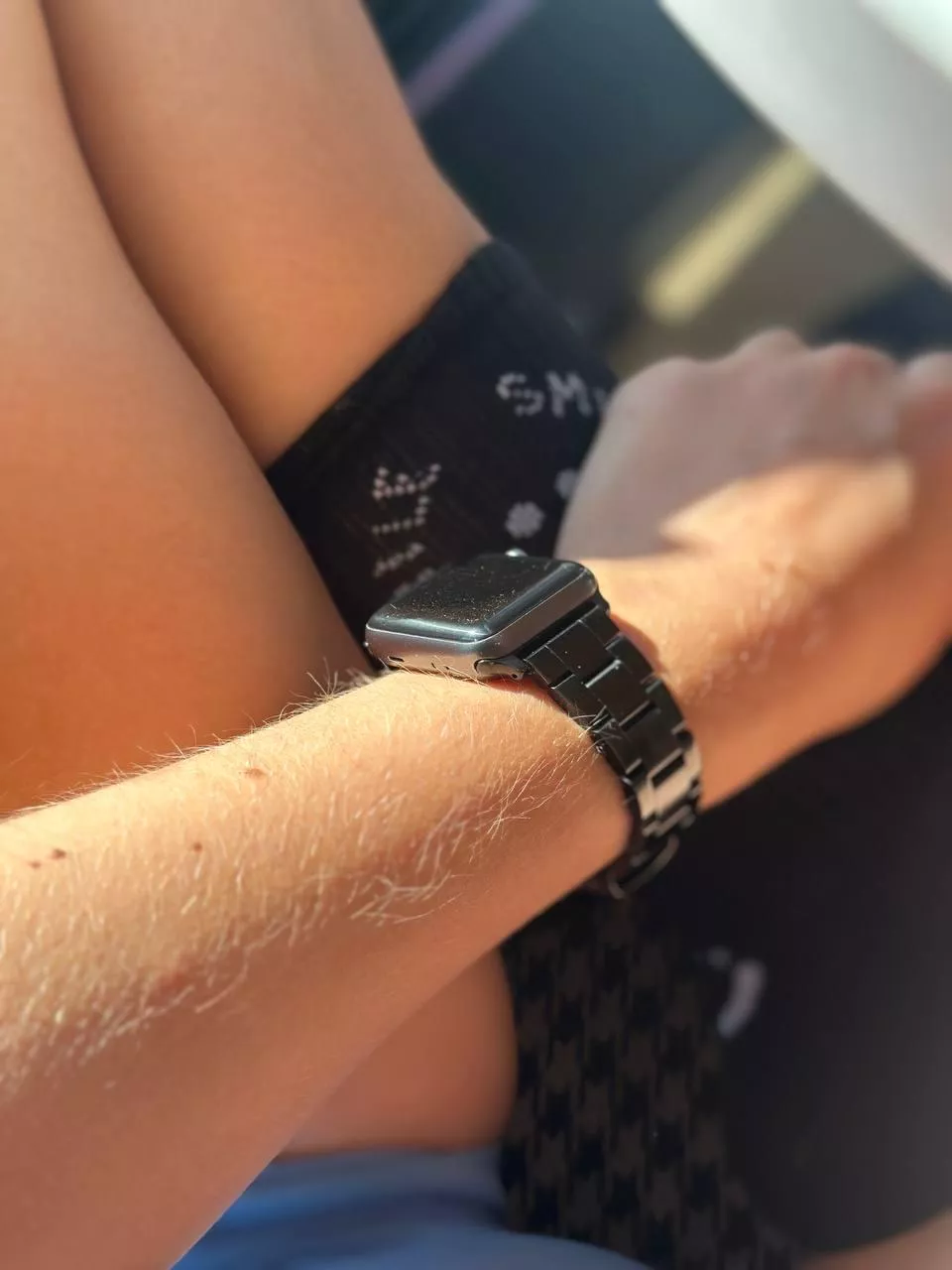 fuzzy arm posted by strungdelorme