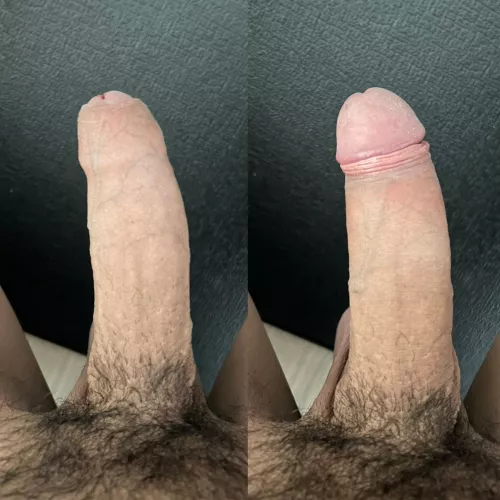 Foreskin Up, Foreskin Down by LowKeyEcho