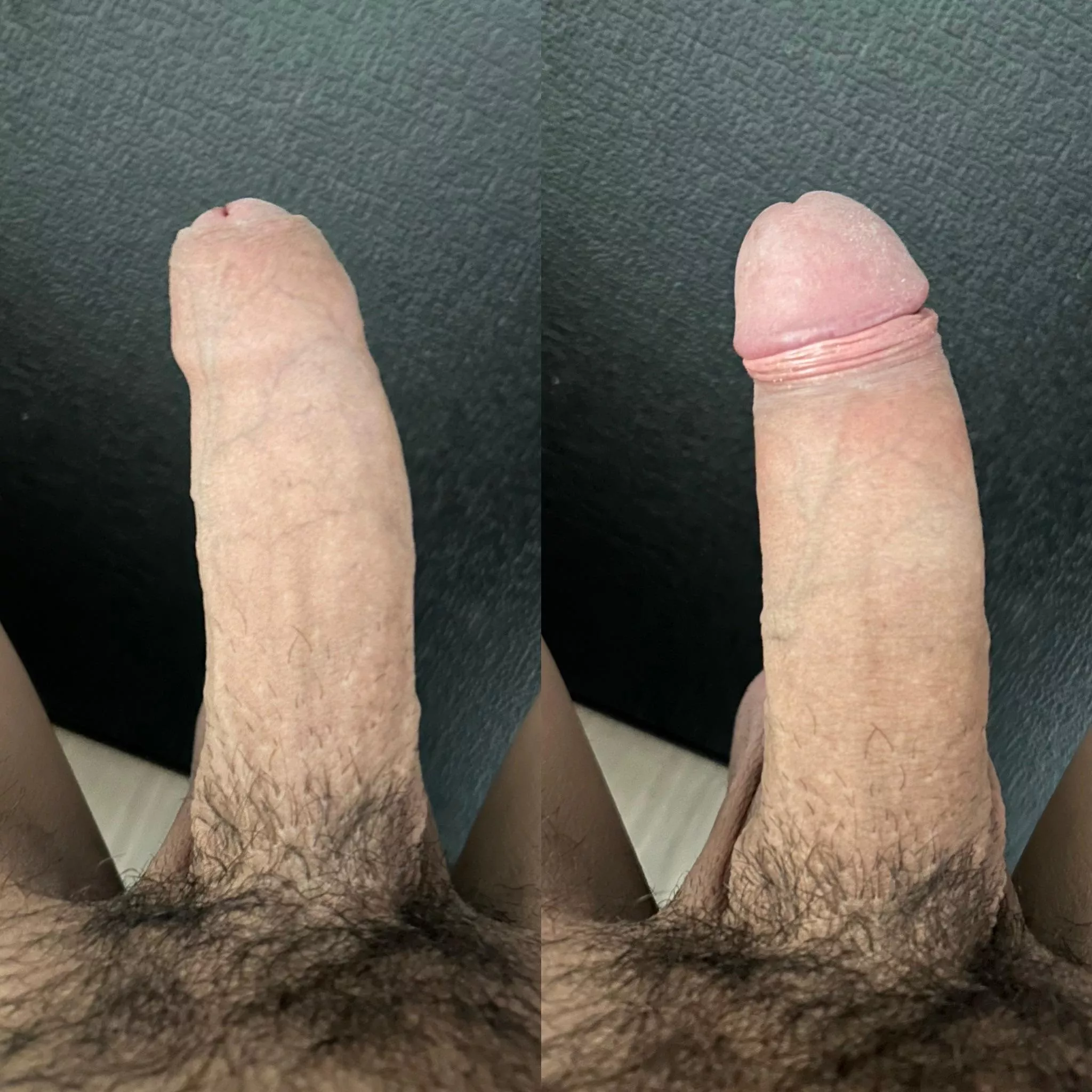 Foreskin Up, Foreskin Down posted by LowKeyEcho