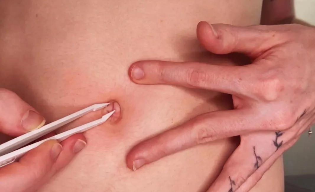 Bellybutton inspection  posted by No_Date366