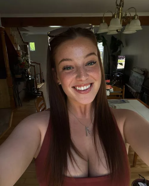 freckles by SeducedByYourBeauty