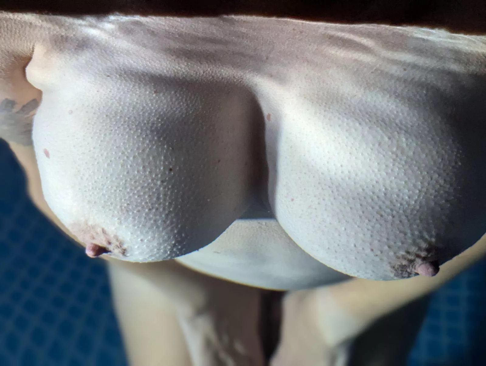 Goosebumps on a chilly swim night  posted by SneffelsSlider