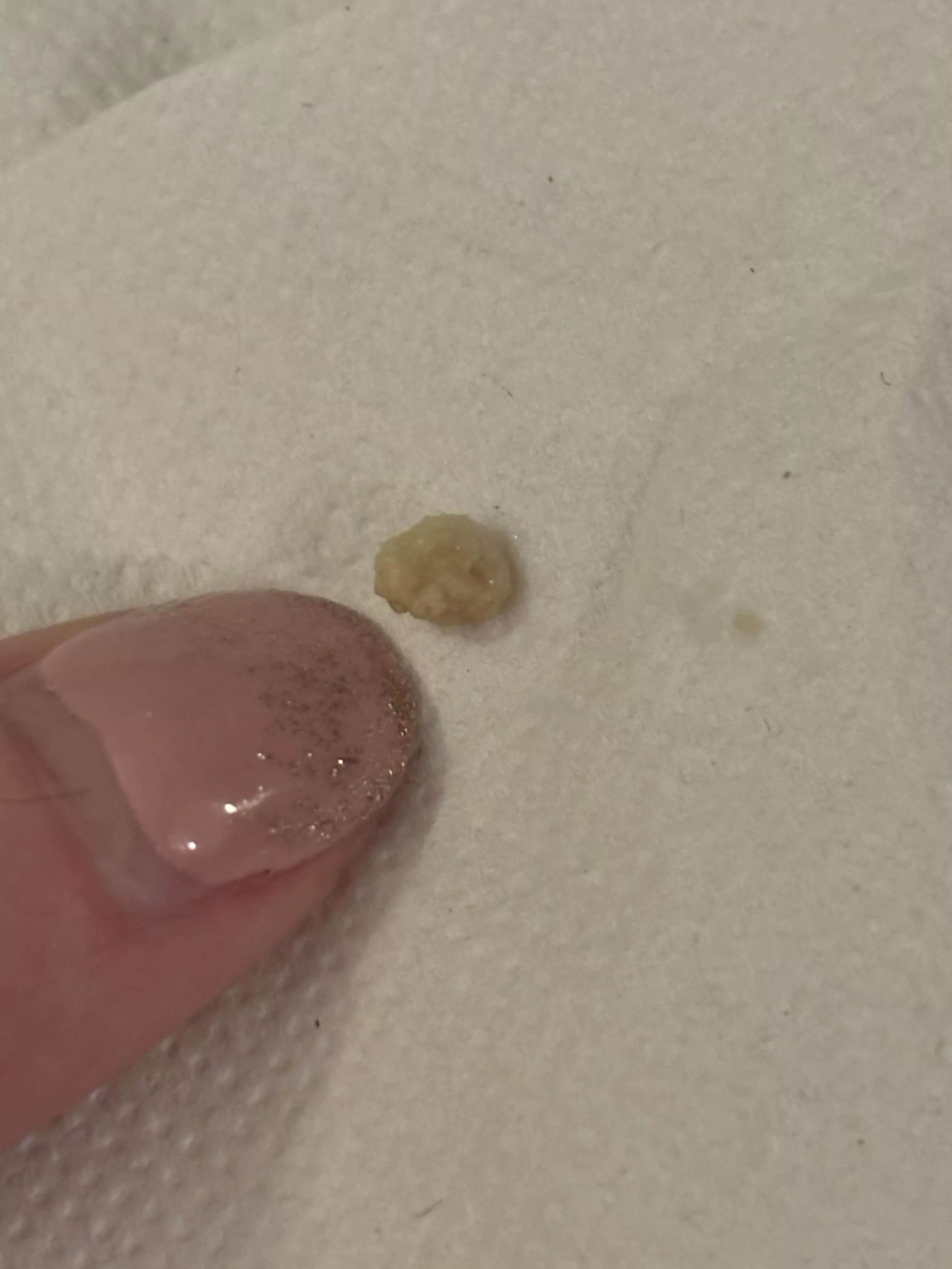 Lil nugget I chucked while sneezing. Haven't seen one of these in a long time! posted by 0ddlySatisfiedAnon