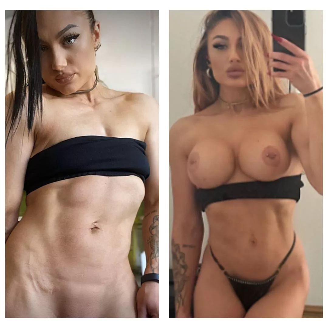 my surgeon deserves a trophy, sure i go for more?  posted by okdiligent83