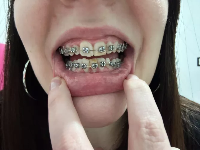 Thread to show my progress: 1 month :) by RebecaClarkBigAss