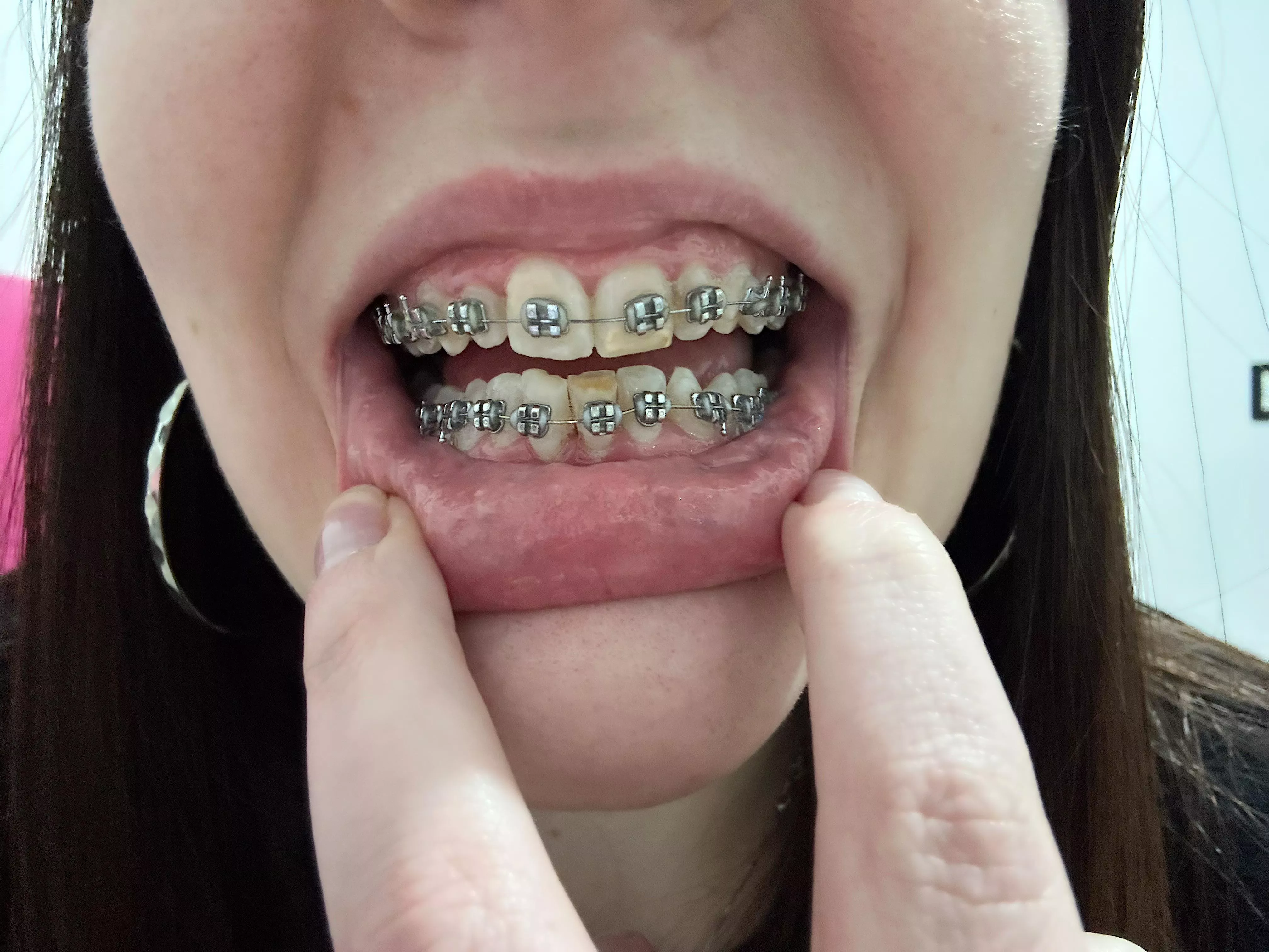 Thread to show my progress: 1 month :) posted by RebecaClarkBigAss