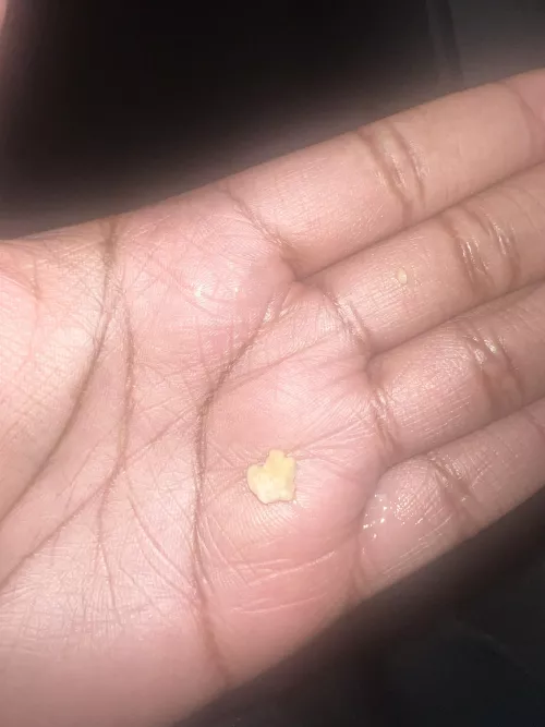 Welp just spent 20 minutes coughing this up by Fantastic_Advantage5